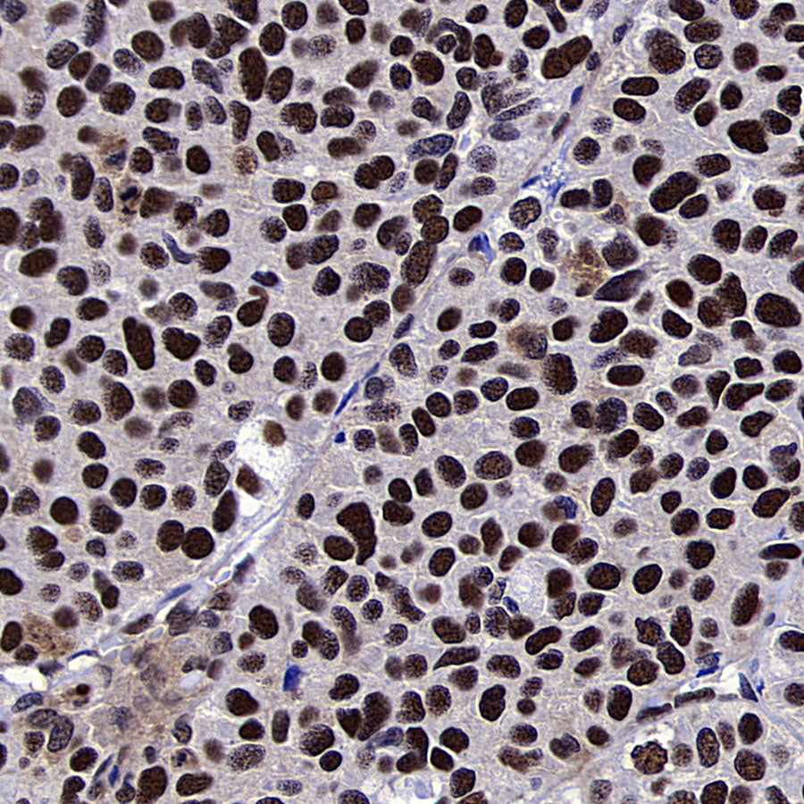 METTL1 Recombinant Rabbit mAb (S-4435-6)
