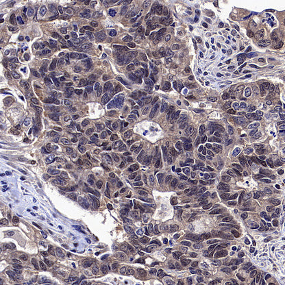 IRF3 Recombinant Rabbit mAb (S-3650-63)