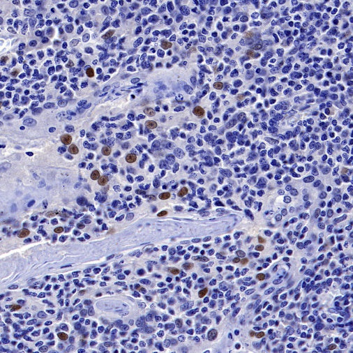 p21 Waf1/Cip1 Mouse mAb (469-2)