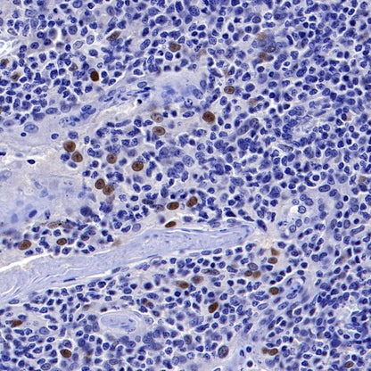 p21 Waf1/Cip1 Mouse mAb (469-2)