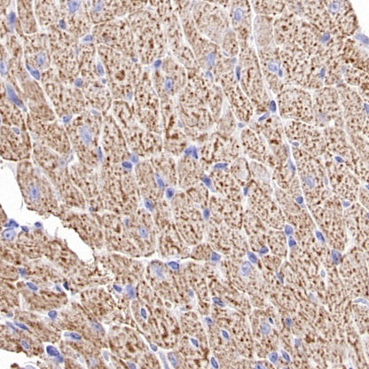 VDAC1 + VDAC2 + VDAC3 Rabbit Polyclonal Antibody