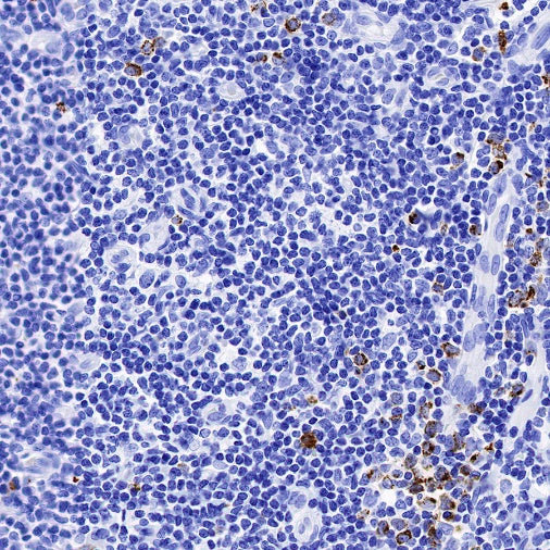 Granzyme B Recombinant Rabbit mAb (S-357-54)
