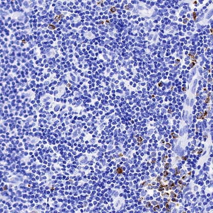 Granzyme B Recombinant Rabbit mAb (S-357-54)