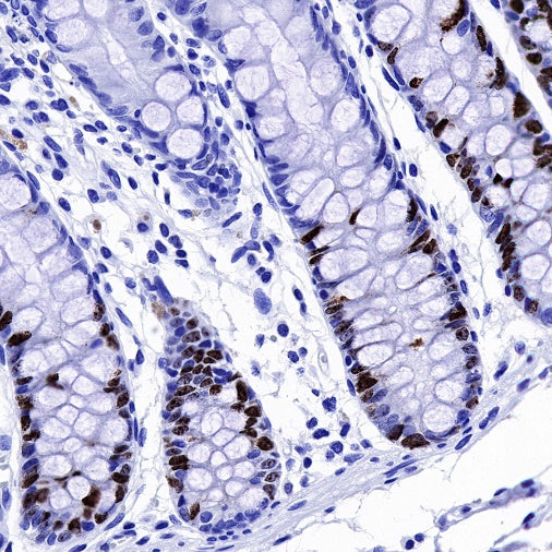 S-RMab® Ki67 Recombinant Rabbit mAb (SDT-R459)
