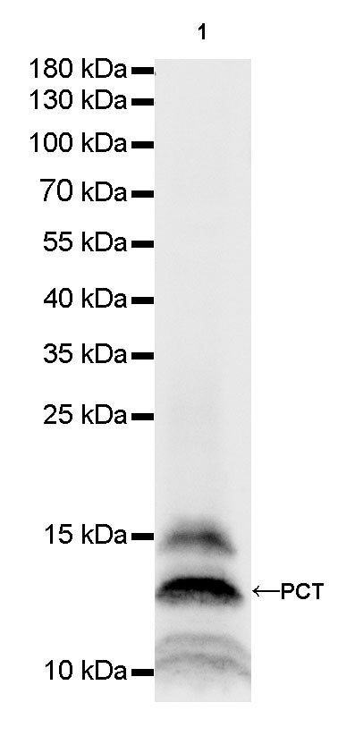 PCT Recombinant Rabbit mAb(SDT-050-58)