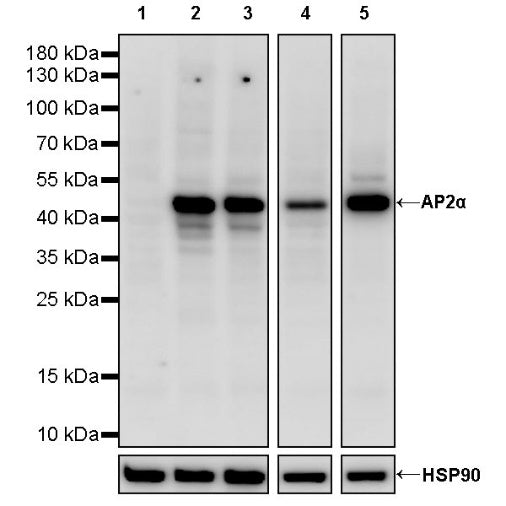 AP2α Recombinant Rabbit mAb (S-2376-7)