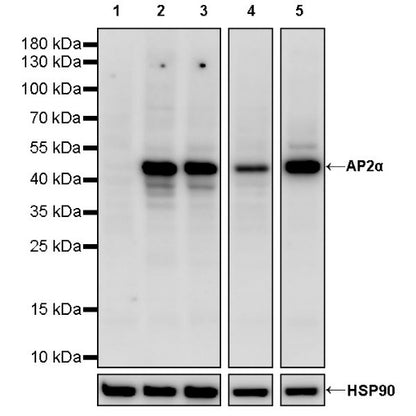 AP2α Recombinant Rabbit mAb (S-2376-7)