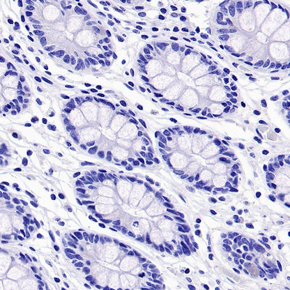 DLL3 Recombinant Rabbit mAb (S-207-179)