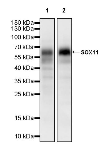 SOX11 Recombinant Mouse mAb (SDT-919-58)