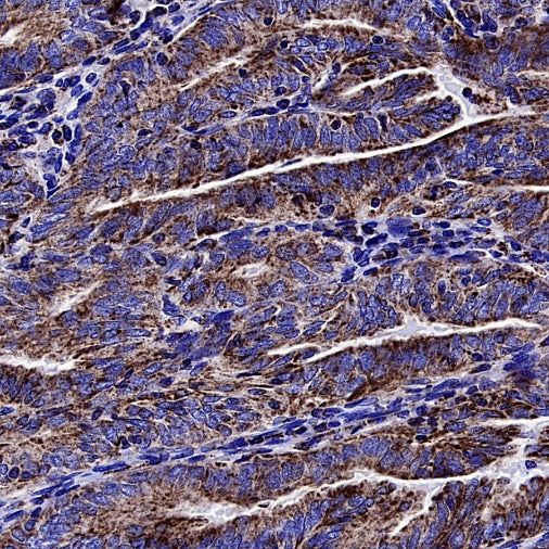 Cleaved Caspase-3 (Asp175) Recombinant Rabbit mAb (S-2817)
