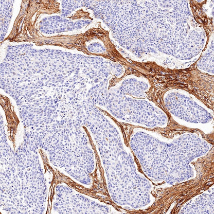 Collagen VI (COL6A1) Recombinant Rabbit mAb (S-1495-18)