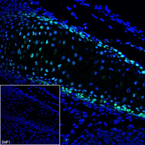 Sp7/Osterix Recombinant Rabbit mAb (SDT-3238-16)
