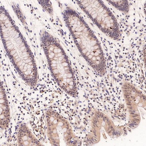 NEK7 Recombinant Rabbit mAb (S-2494-70)