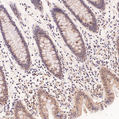NEK7 Recombinant Rabbit mAb (S-2494-70)