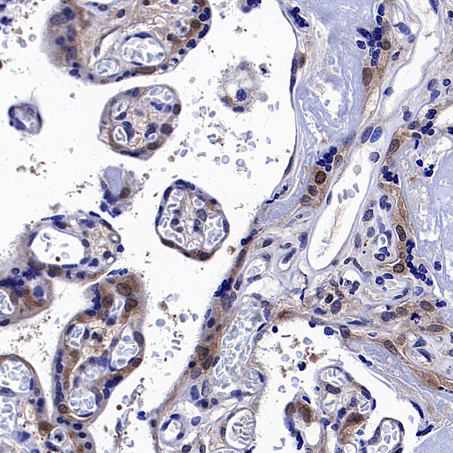 IRF3 Recombinant Rabbit mAb (S-3650-63)