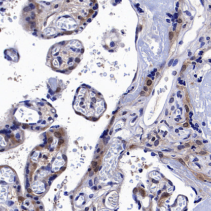 IRF3 Recombinant Rabbit mAb (S-3650-63)