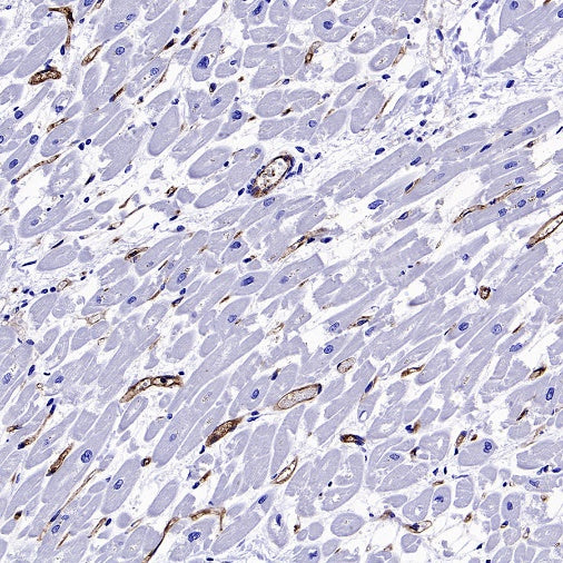 Angiotensin Converting Enzyme 1 Recombinant Rabbit mAb (SDT-2662-122)