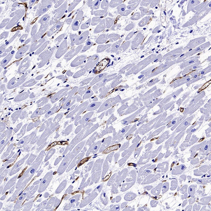 Angiotensin Converting Enzyme 1 Recombinant Rabbit mAb (SDT-2662-122)