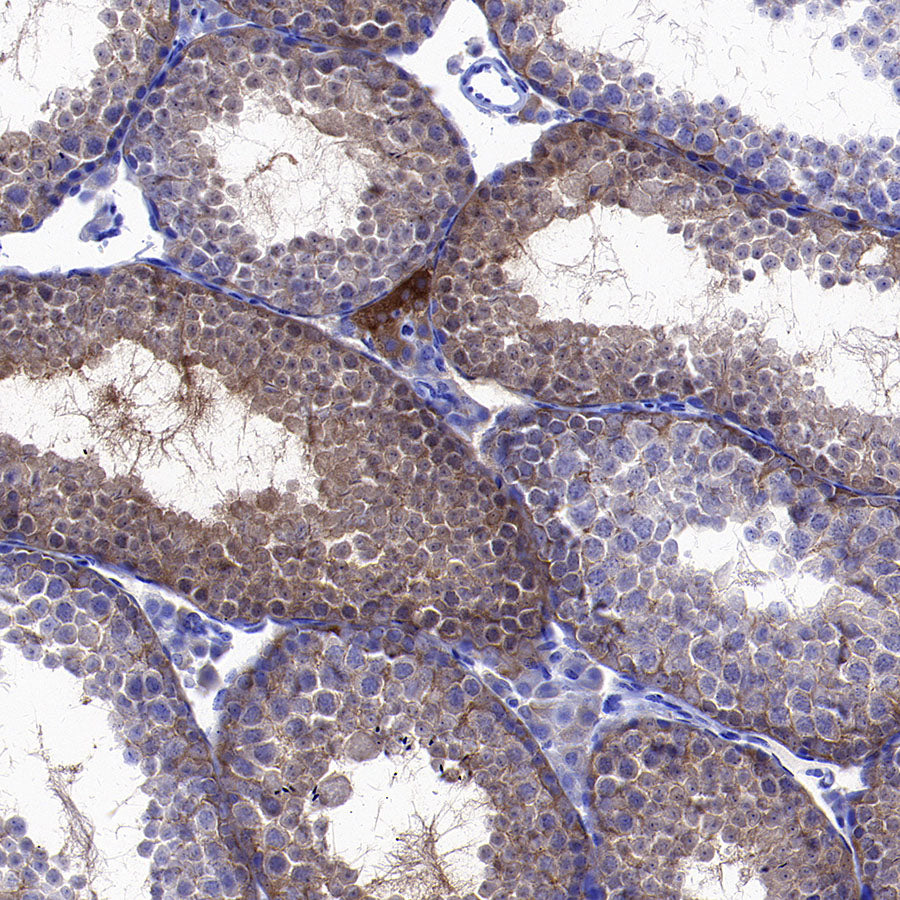 Inhibin alpha Recombinant Rabbit mAb (SDT-3212-24)