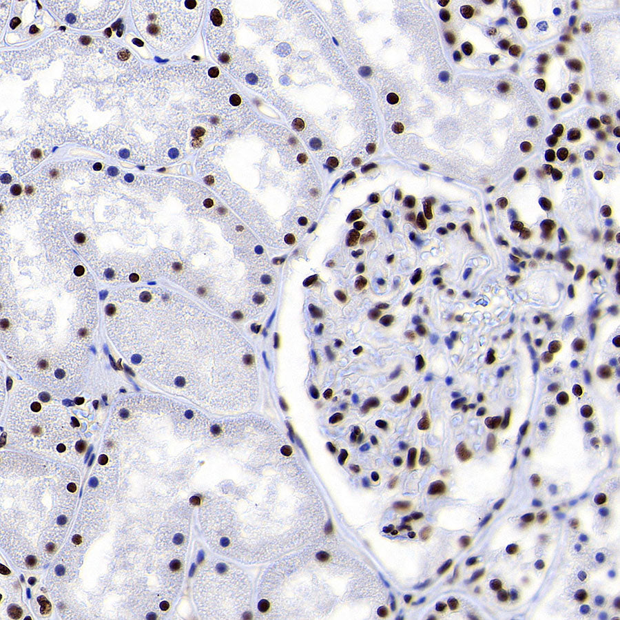 RBBP4 Rabbit Polyclonal Antibody