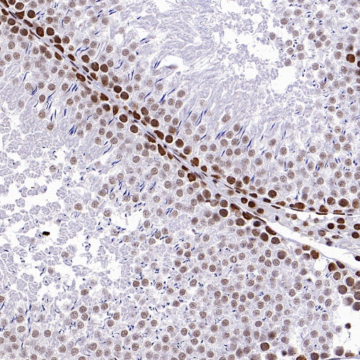 ENT2 Rabbit Polyclonal Antibody