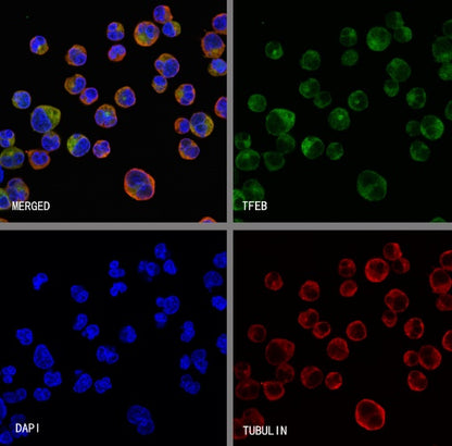 TFEB Recombinant Rabbit mAb (SDT-2411-7)