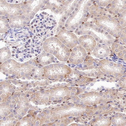SMAD3 Recombinant Rabbit mAb (S-3147-36)