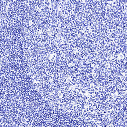 CGA/HCG-α Recombinant Rabbit mAb (SDT-227-66)