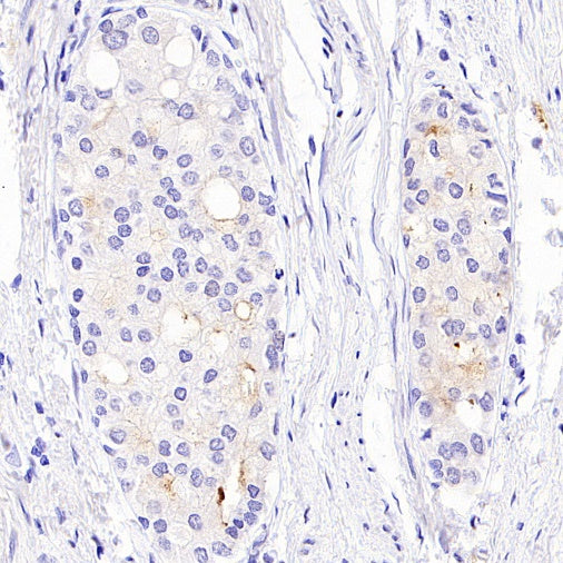 GDF3 Recombinant Rabbit mAb (S-3049-3)