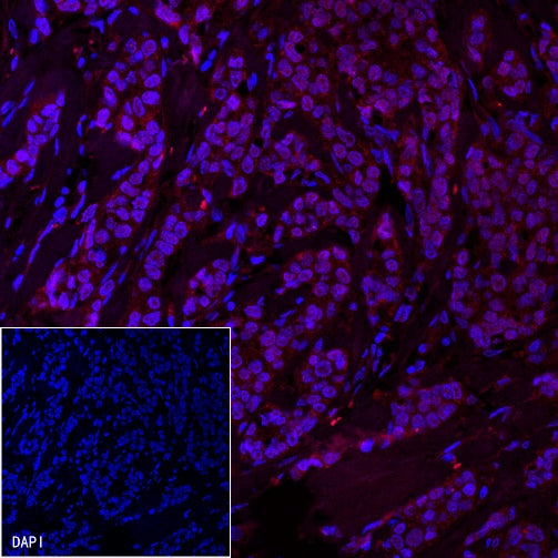 Androgen Receptor Recombinant Rabbit mAb (Alexa Fluor® 594 Conjugate) (SDT-R167)