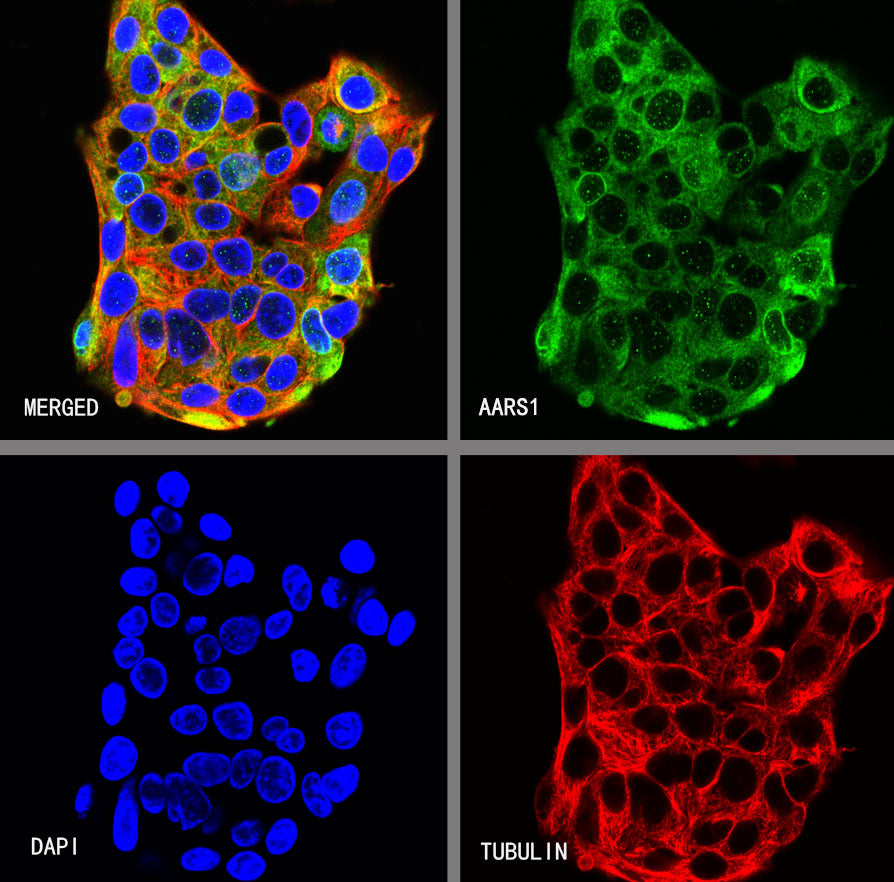 AARS1 Rabbit Polyclonal Antibody