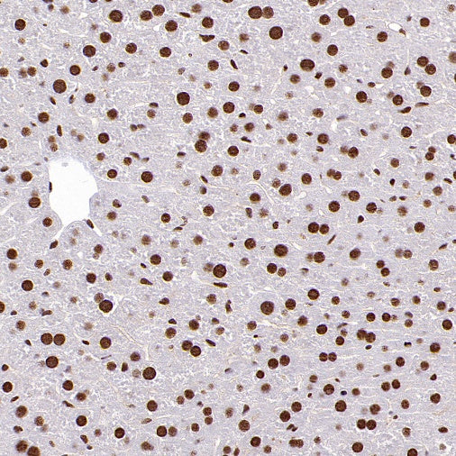 ENT2 Rabbit Polyclonal Antibody
