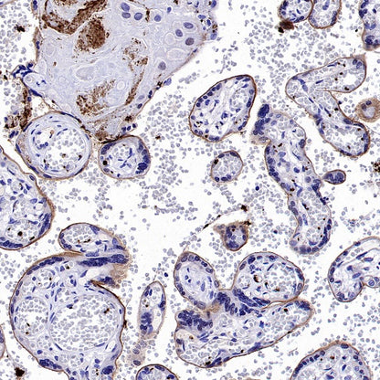 CD61 Recombinant Rabbit mAb (S-2515-6)