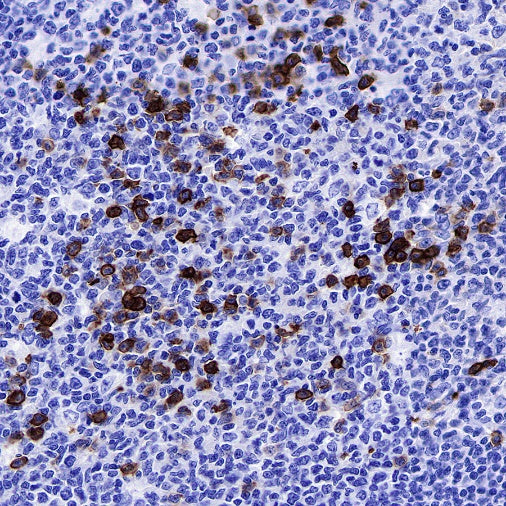 CD38 Mouse mAb (S-690-29)