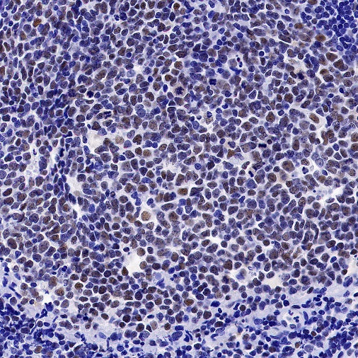 S-RMab® PMS2 Recombinant Rabbit mAb (SDT-R460)