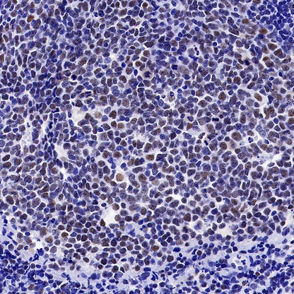S-RMab® PMS2 Recombinant Rabbit mAb (SDT-R460)