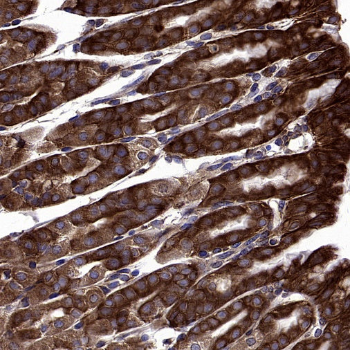 YB1 Recombinant Rabbit mAb (S-1748-144)