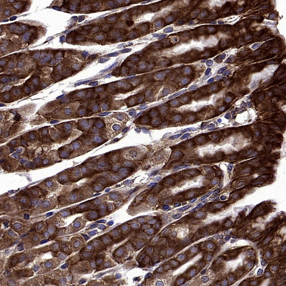 YB1 Recombinant Rabbit mAb (S-1748-144)