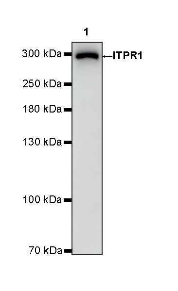 ITPR1 Recombinant Rabbit mAb (S-4530-47)