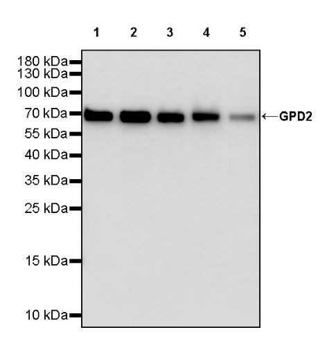 GPD2 Recombinant Rabbit mAb (S-2941-41)