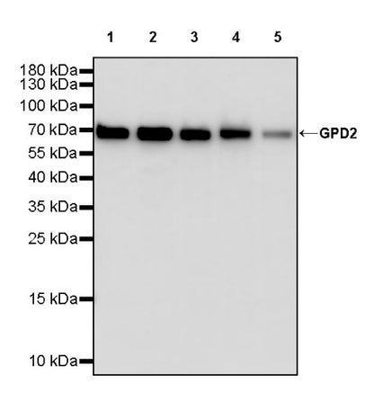 GPD2 Recombinant Rabbit mAb (S-2941-41)