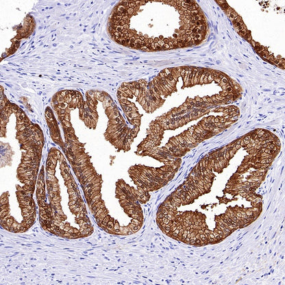 14-3-3 sigma Recombinant Rabbit mAb (S-2017-59)