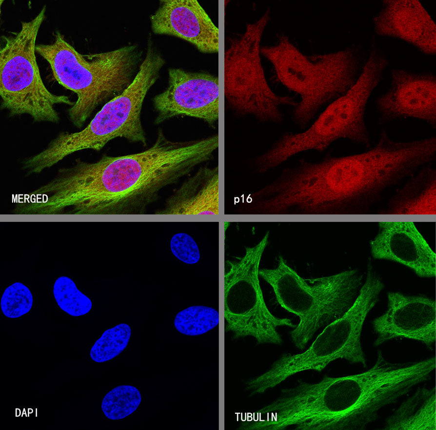 p16 Recombinant Rabbit mAb (S-303-1)