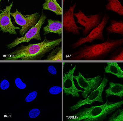 p16 Recombinant Rabbit mAb (S-303-1)