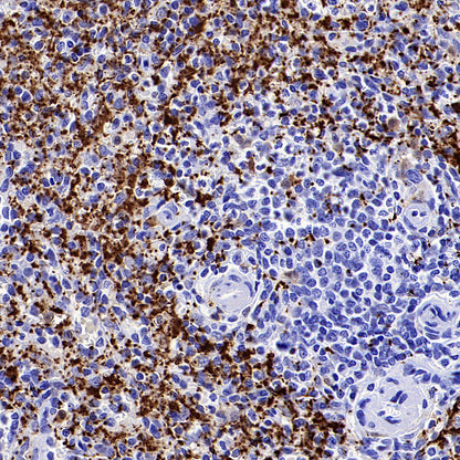 AOAH Recombinant Rabbit mAb (S-3713-10)