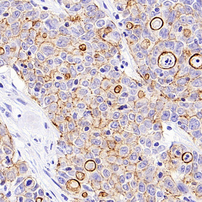 B7-H6 Recombinant Rabbit mAb (SDT-3241-6)