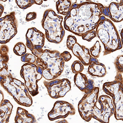 SLC43A2 Recombinant Rabbit mAb (S-4492-33)