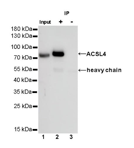 ACSL4/FACL4 Recombinant Rabbit mAb (S-461-6)