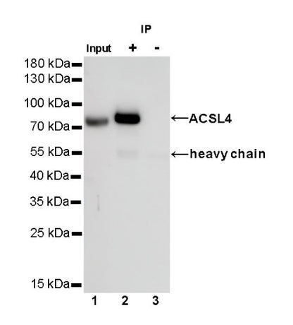 ACSL4/FACL4 Recombinant Rabbit mAb (S-461-6)
