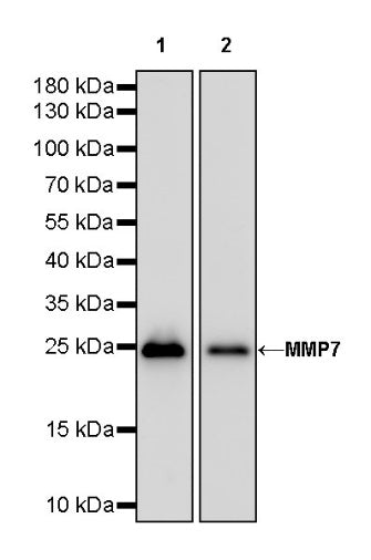 MMP7 Recombinant Rabbit mAb (S-1628-25)